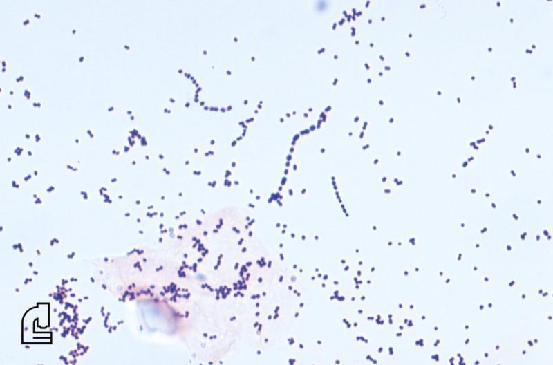 mycobacterium smegmatis gram stain