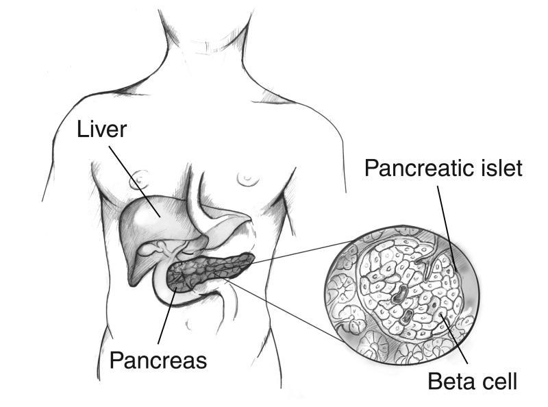 Pancreatic inslet